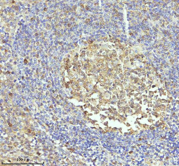IHC - Anti-Caspase 3 Rabbit Monoclonal Antibody ABO16560